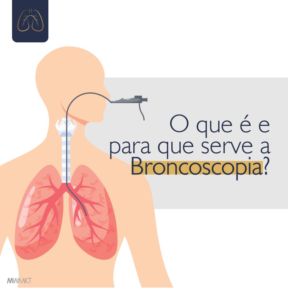 Broncoscopia – Endoscopia Respiratória – O que é e para que serve?