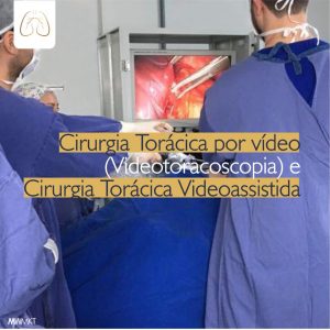 Imagem de uma equipe médica realizando uma cirurgia torácica por vídeo