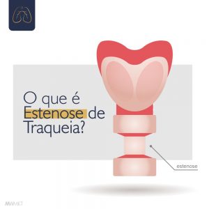 A ilustração mostra um diagrama da traqueia, com uma área estreitada destacada em vermelho. Há um texto ao lado da imagem que pergunta 'O que é Estenose de Traqueia?'